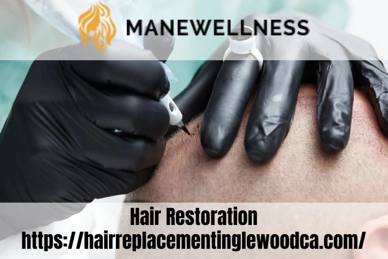 Images Mane Wellness Hair Loss Center