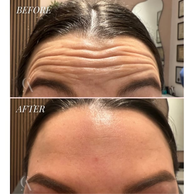 Images Corinne Aesthetics | Laser & Skin