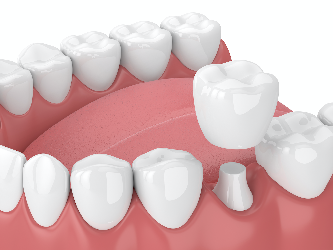 Image 4 | Mass Dental Associates