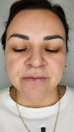 Images Obtain Confidence | Med Spa