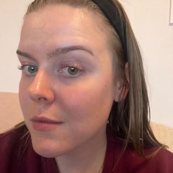 Images DERMA GLOW SOUTH YARRA ( Formerly Known as ALS)