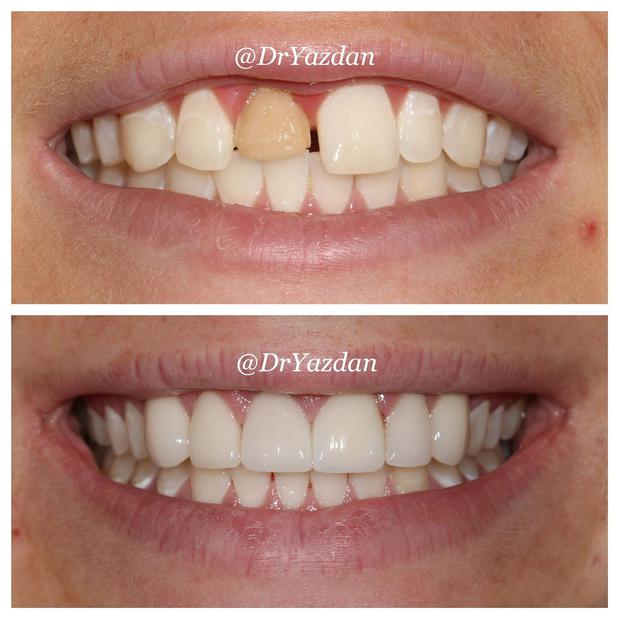 Images Dr. Desiree Yazdan - Center For Restorative & Cosmetic Dentistry
