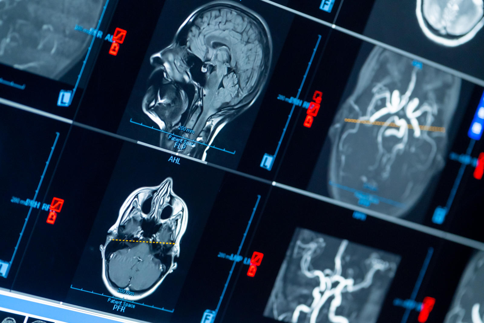 Bild 17 Dr. Lins | Ihre MRT Radiologie Privatpraxis Nürnberg | Schnelle Termine | Vorsorge und mehr in Nürnberg