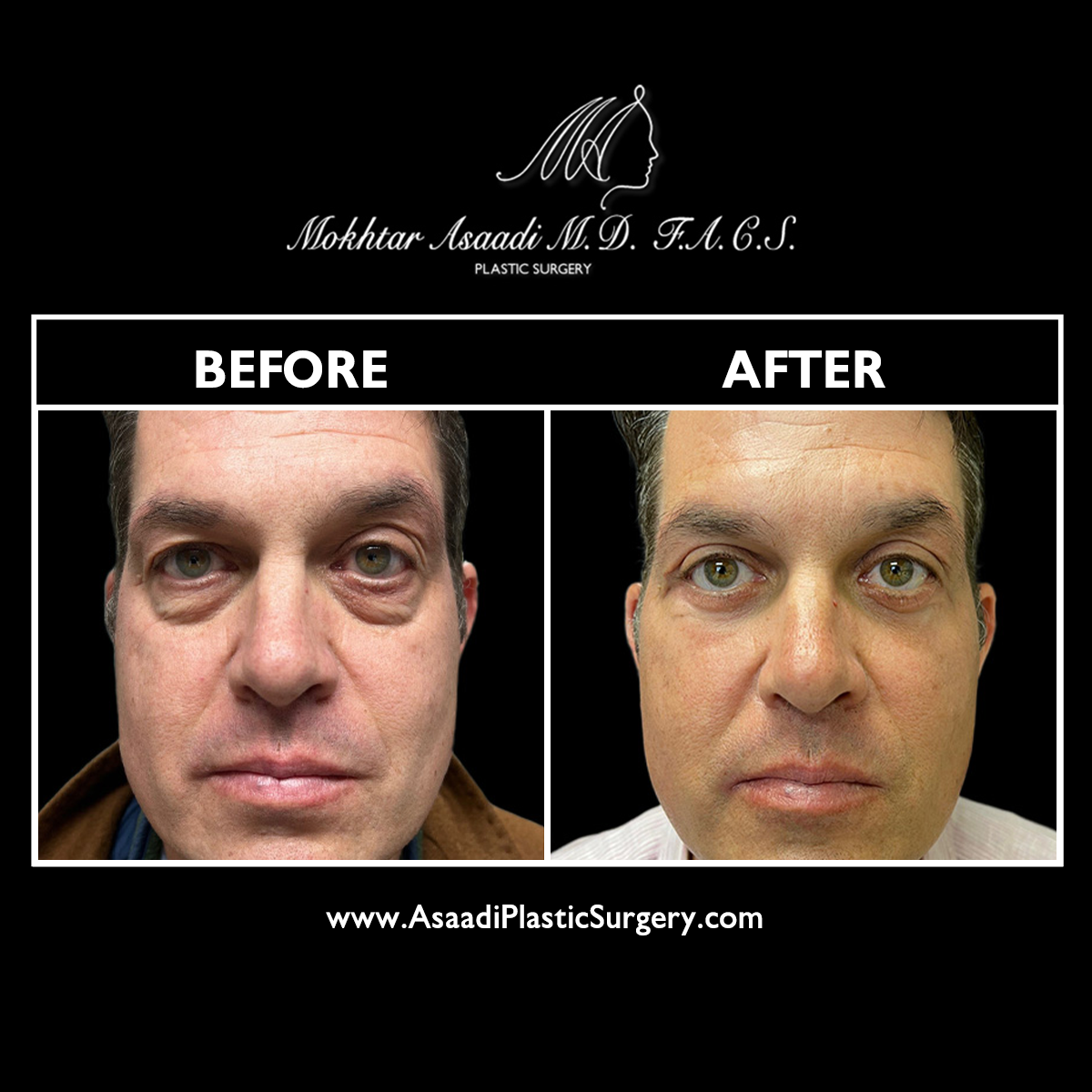 Asaadi Plastic Surgery Image