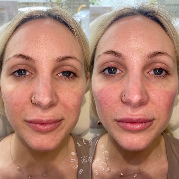 Images BCRN Aesthetics MedSpa