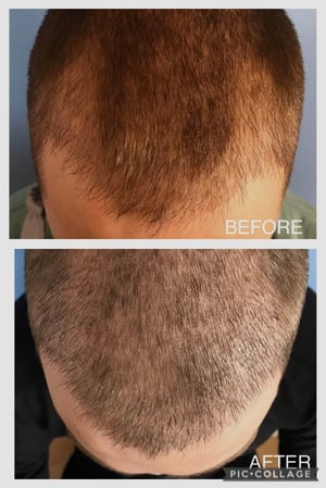 Images Dr. George Brennan - Cosmetic Surgeon Newport Beach