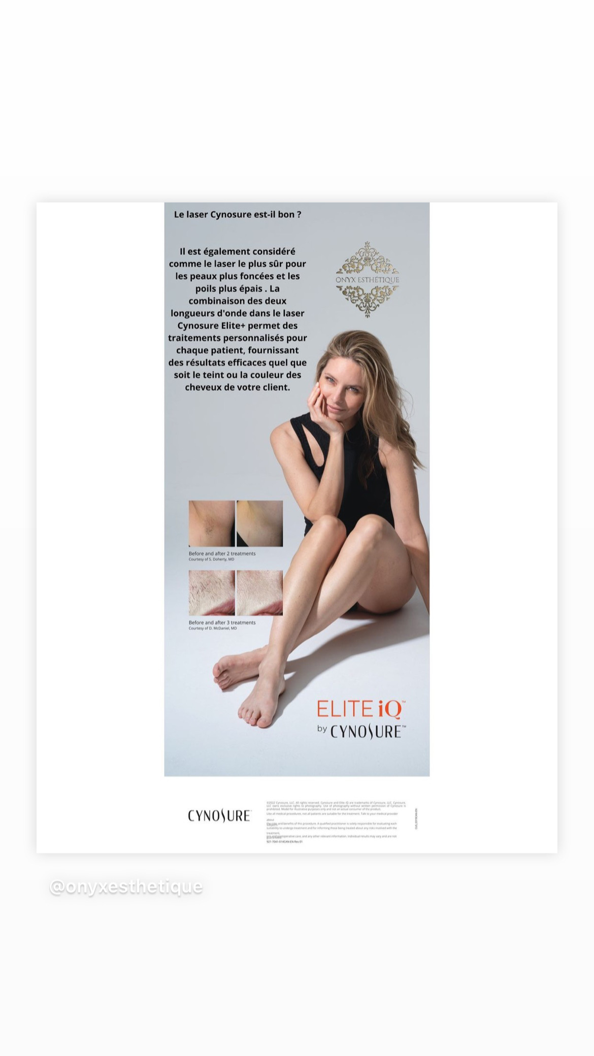 Images Onyx Esthétique - Soins esthétiques, Soins de la peau, Laser Cynosure Gatineau