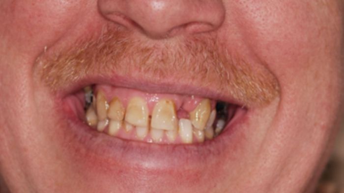 Images Enrich Dental