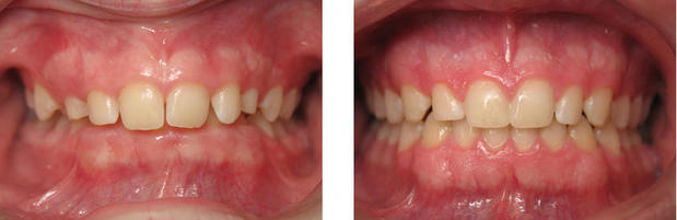 Images Wirtz Orthodontics