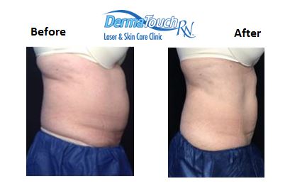 Images DermaTouch RN