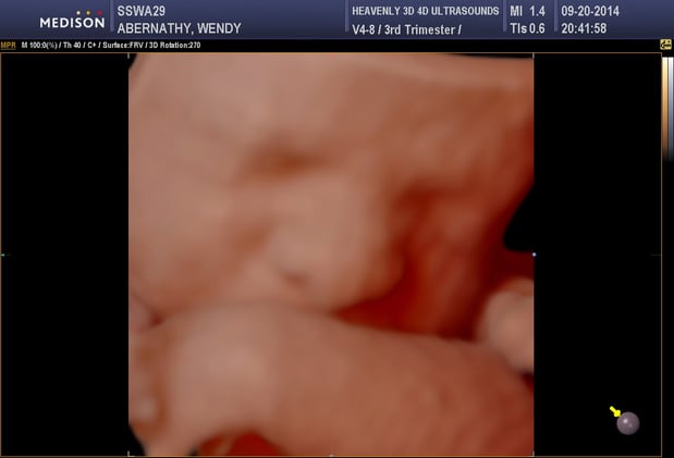 Images Heavenly 3D 4D Ultrasounds-Upland