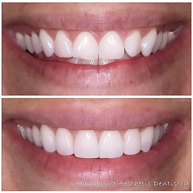 Images Hammond Aesthetic & General Dentistry