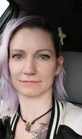 Images NP Aesthetics Las Vegas