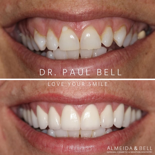 Images Almeida & Bell Dental Lone Tree - General, Cosmetic, and Implant Dentistry