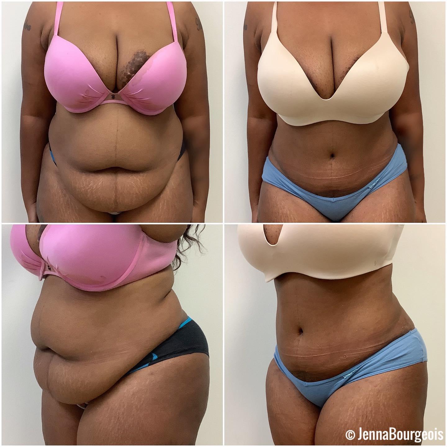 Dr. Jenna M. Bourgeois MD Image