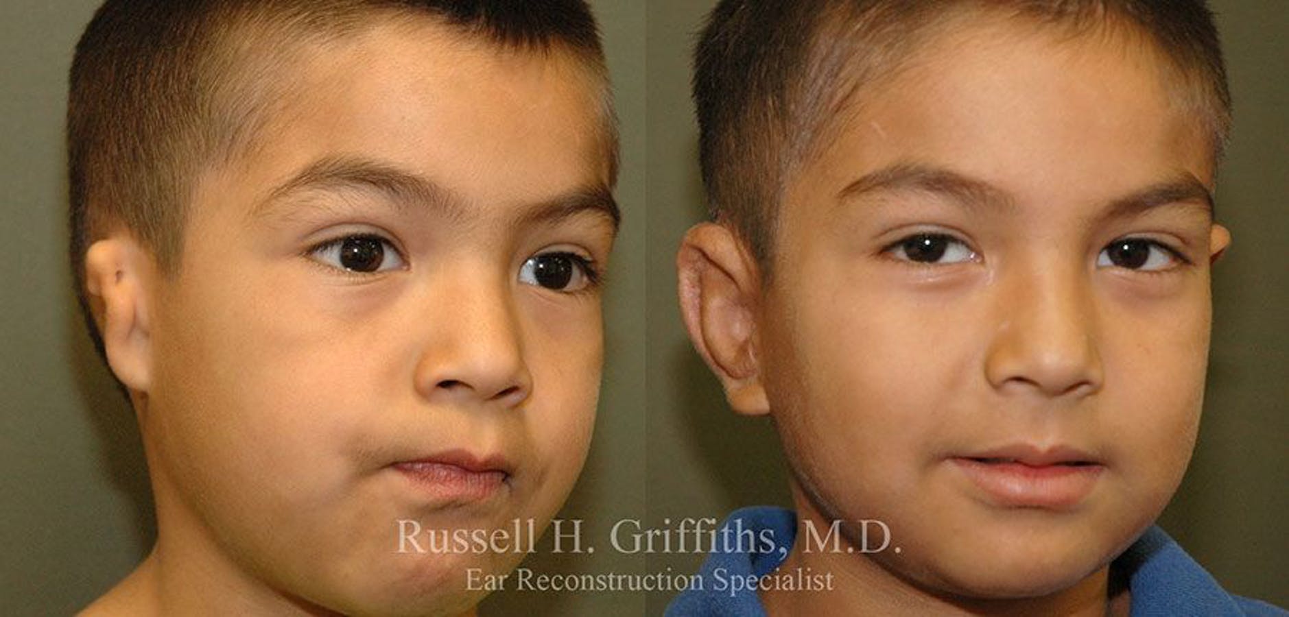 Results of Russell H. Griffiths, MD | Boise, ID
