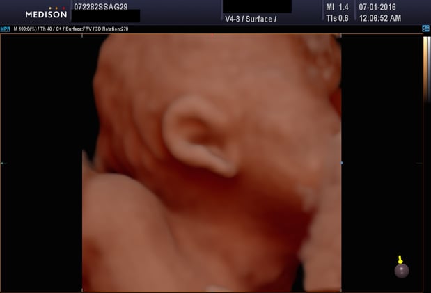 Images Heavenly 3D 4D Ultrasounds