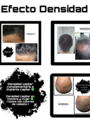 Images Giorgia Hair Clinic