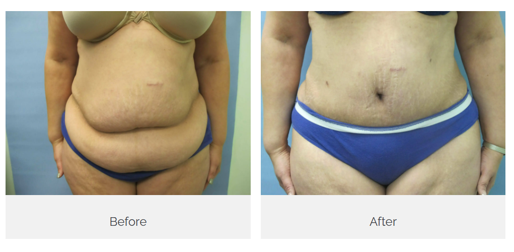 Castellano Cosmetic Surgery Center Image