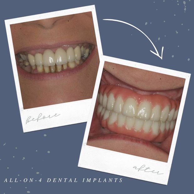 Images Ridgewood Dental Associates