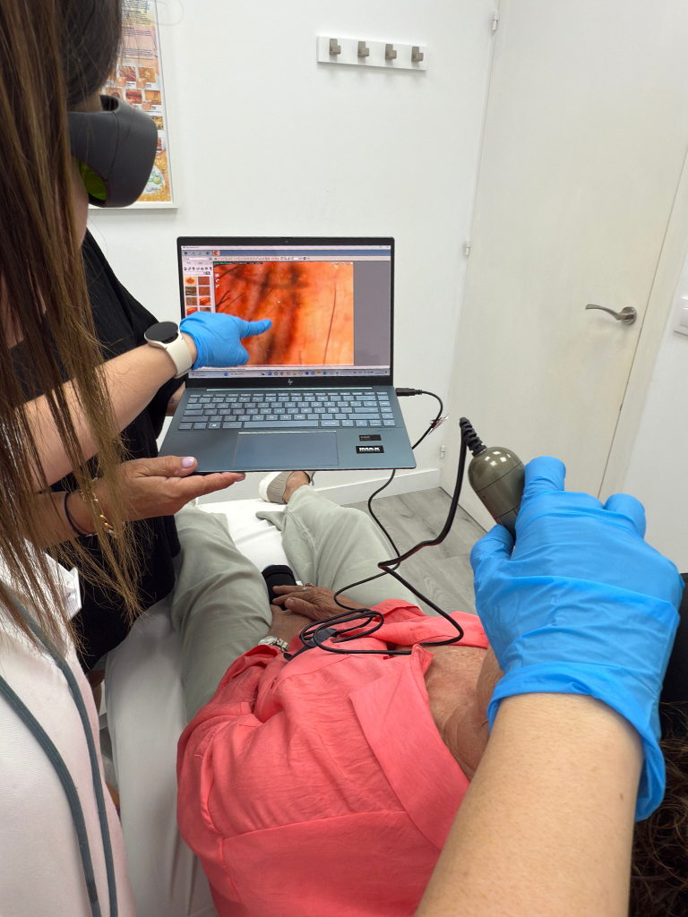 Images Dra. Silvia Solà. Medicina Estética y Láser