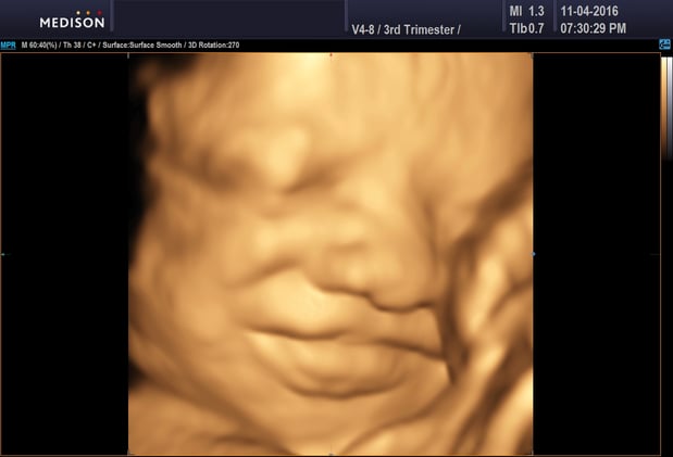 Images Heavenly 3D 4D Ultrasounds