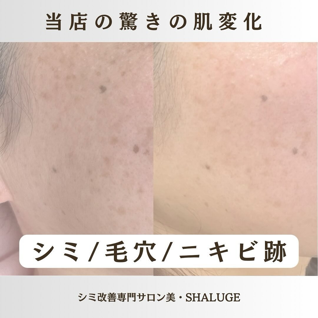 Images 美・SHALUGE