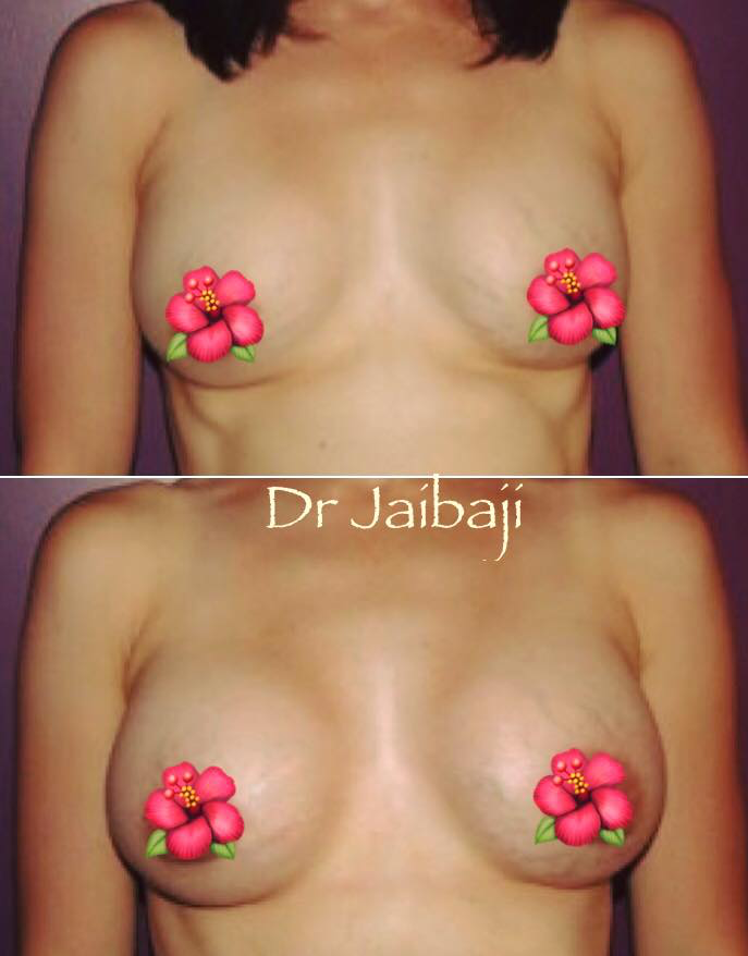 Jaibaji Plastic Surgery Photo