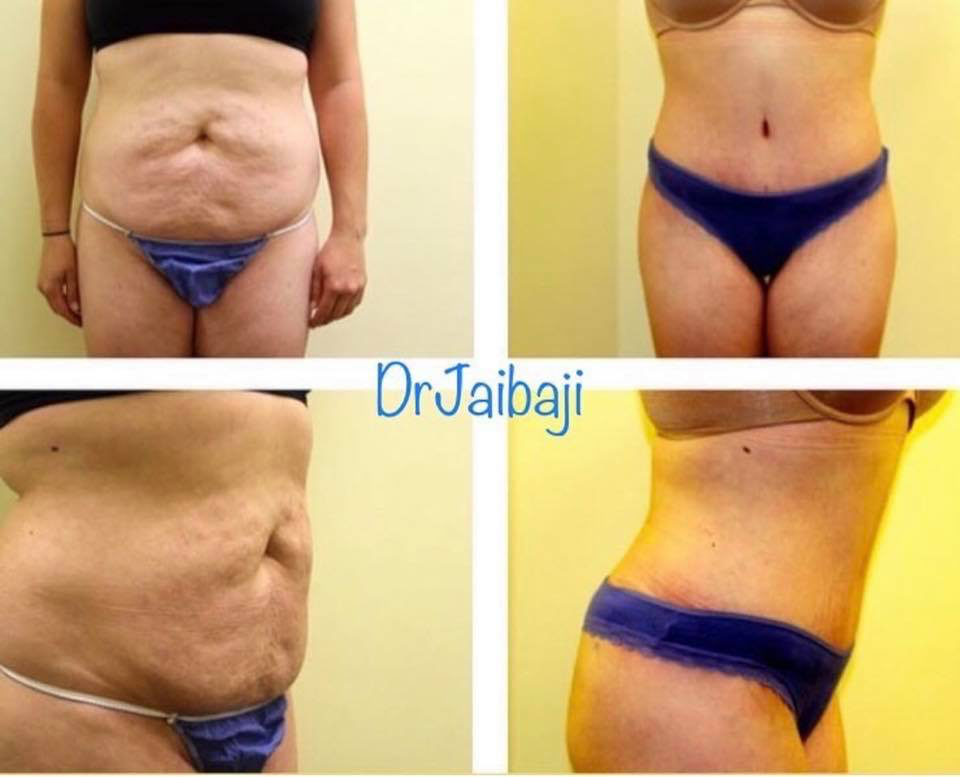 Jaibaji Plastic Surgery Photo