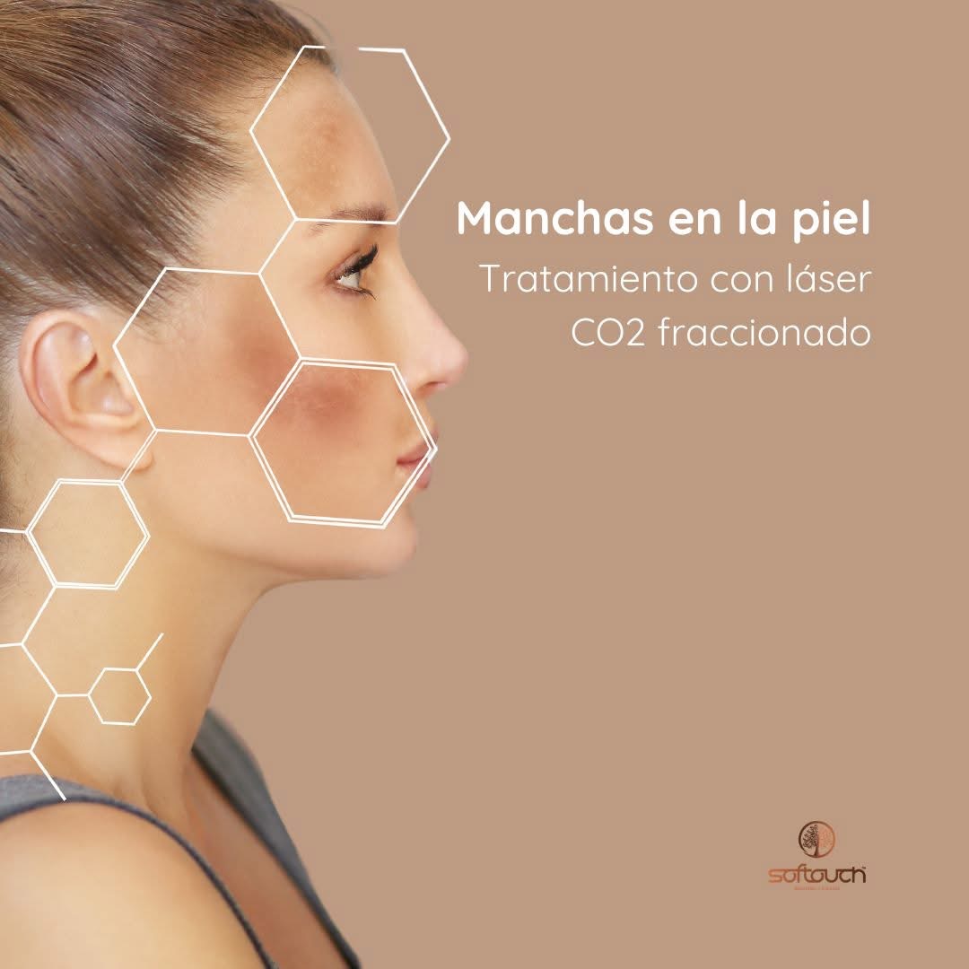 Images Softouch Medicina y Cirugía Estética