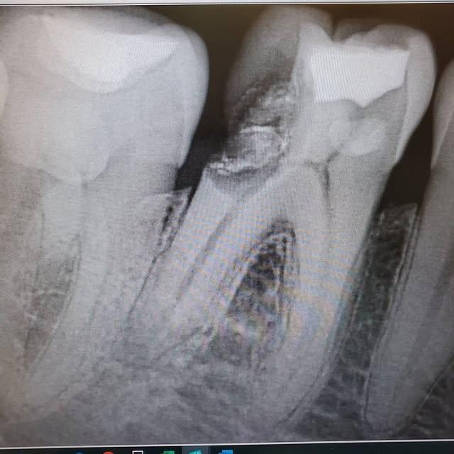 Images Smiles By Eddie: Dr. Edmond Ahdoot DDS
