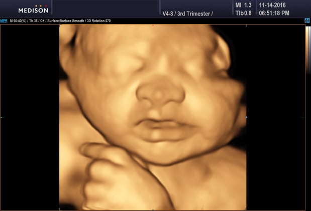 Images Heavenly 3D 4D Ultrasounds