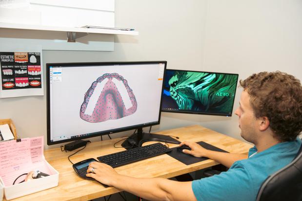 Images Restore In 24 Dental Implants