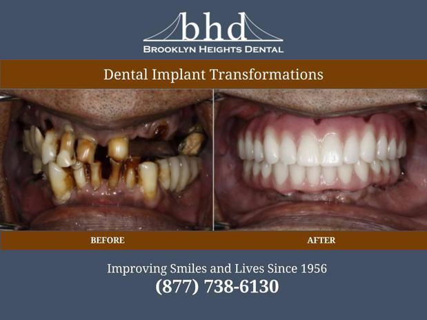 Images Brooklyn Heights Dental