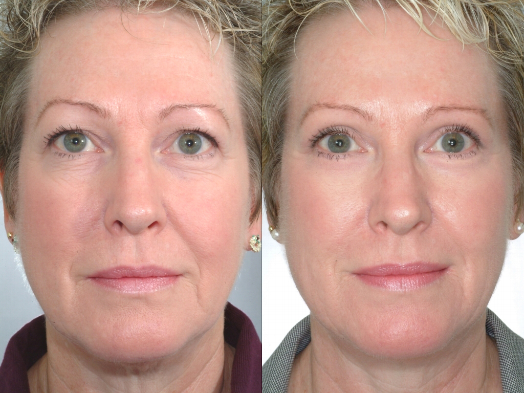 Gateway Aesthetic Institute And Laser Center Skin Treatments Salt