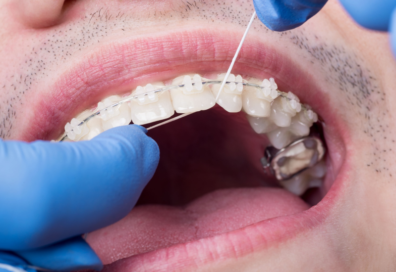 Images Croazia Dental Italia | Studio Dentistico | Vignola