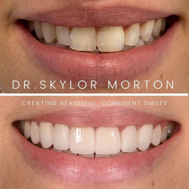 Images Nashville Wisdom Teeth and Implant Solutions