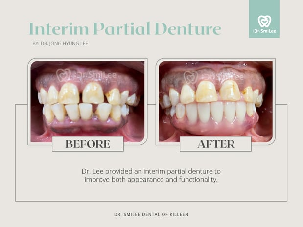 Images Dr Smilee Dental of Killeen, Family, Cosmetic, Implant, Medspa