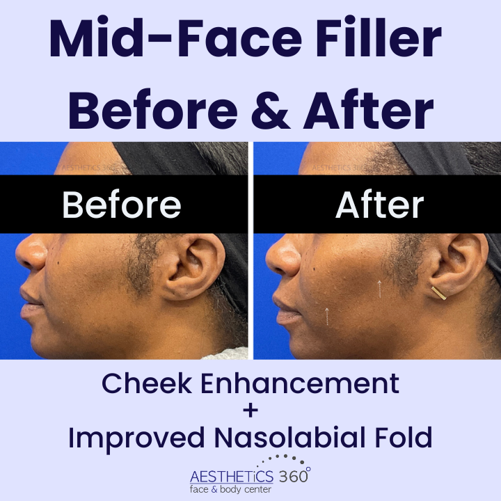 Images AESTHETICS 360° Face & Body Center