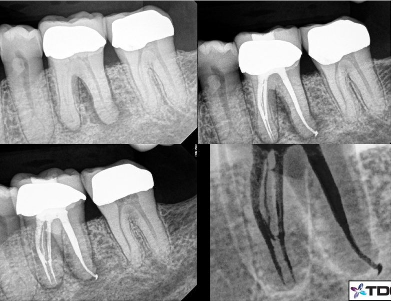 Images Tyler F Baker, DDS MS - Endodontic Specialists