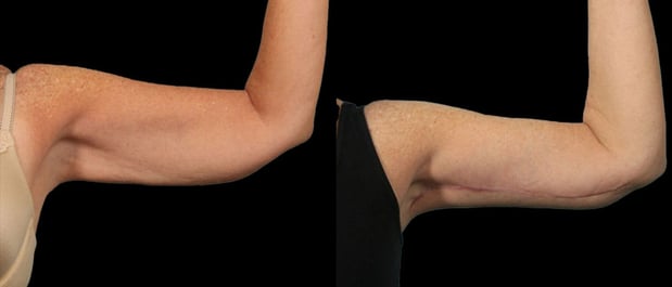 Images Marietta Plastic Surgery