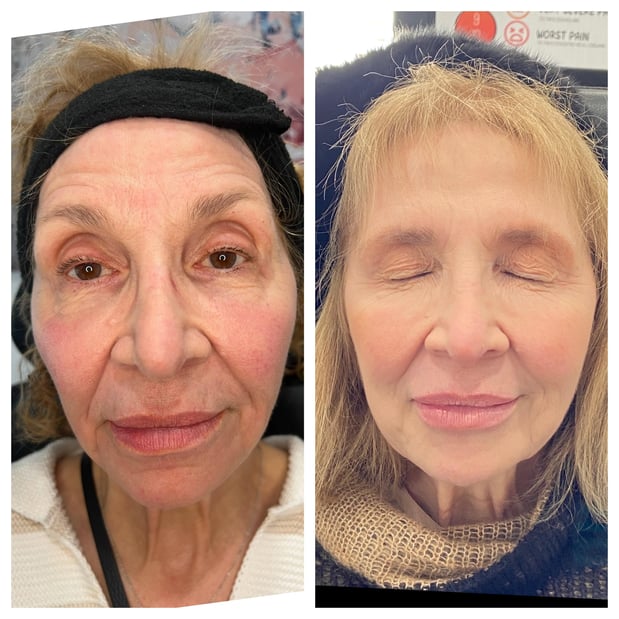 Images Body Lounge Park Cities - Whole Body Wellness & Medical Aesthetics, Dallas, TX