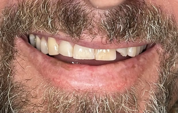Images Nicole E. Kuske, DDS