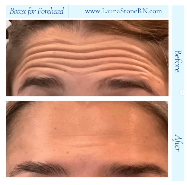 Images Launa Stone, R.N.