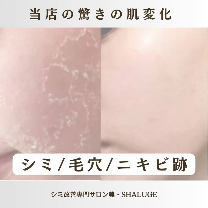 Images 美・SHALUGE