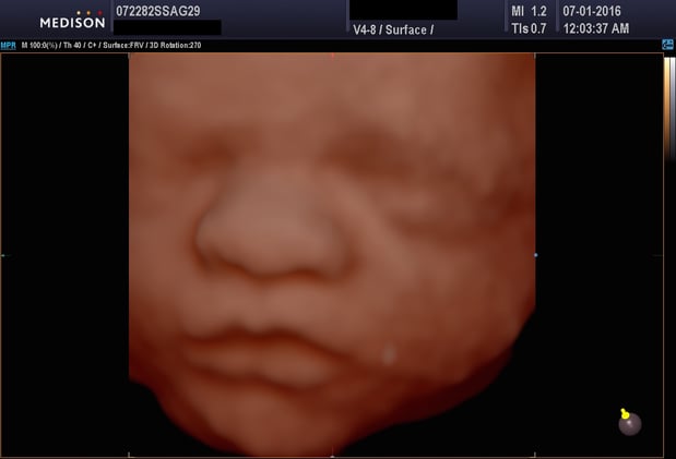 Images Heavenly 3D 4D Ultrasounds