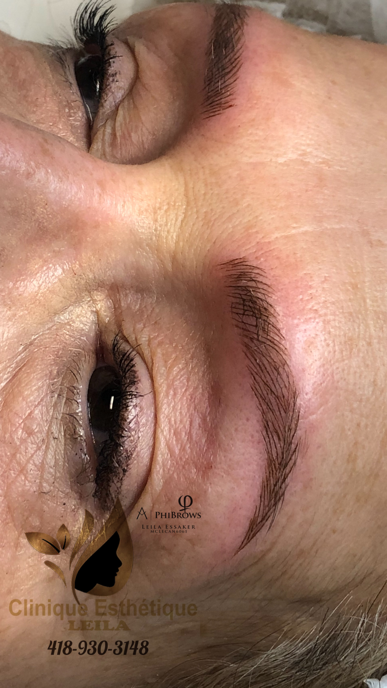 Images Clinique d'Esthétique Leila - Hydrafacial, Microblading, Épilation Laser Sainte-Foy
