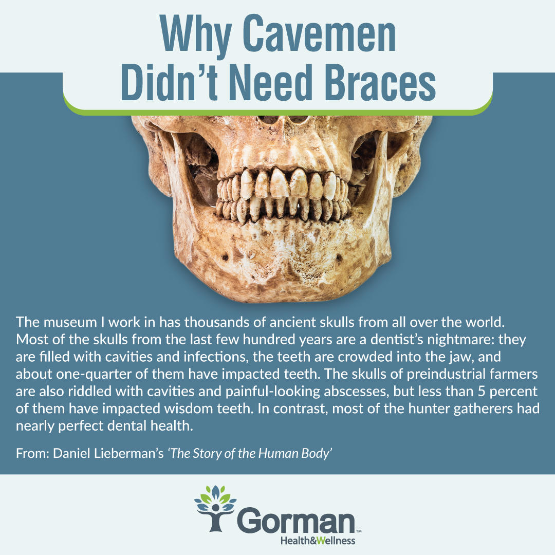 Why cavemen didn't need braces; and now we do. 
#Braces #JawGrowth #TMJ #TMD
