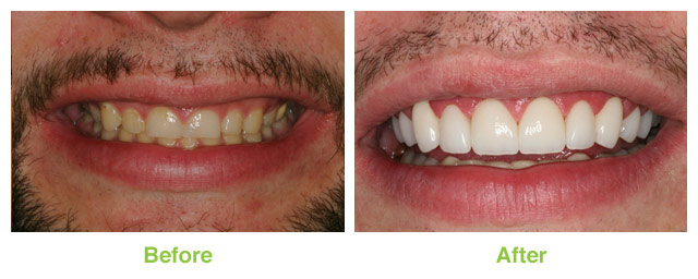 Images Salt Lake Dental Care - Clint Blackwood DDS