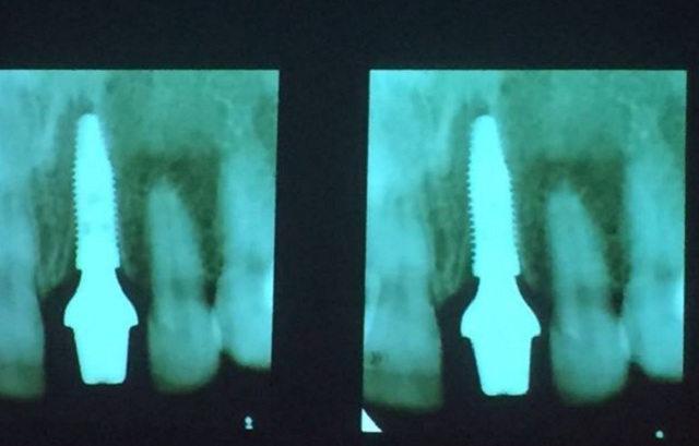 Images Clínica Dental Neodent - Dra. Tamara Carrasco Domínguez